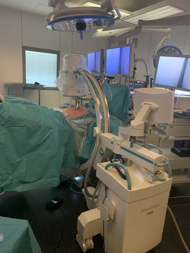 Appareil à rayons X pour la cholangiographie peropératoire en cours de cholécystectomie par laparoscopie au CHR de Huy