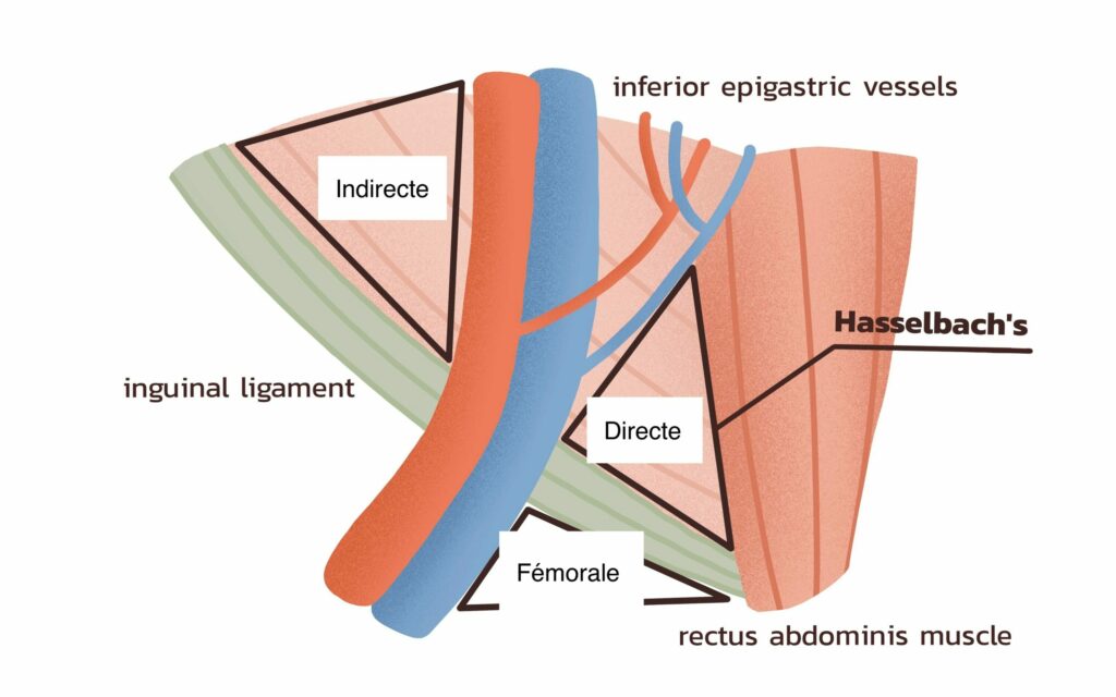 Anatomie des hernies inguinales de l'adulte