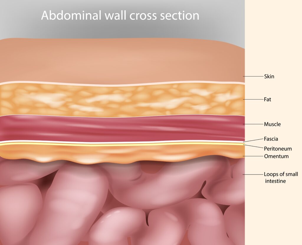 Coupe de la paroi abdominale antérieure